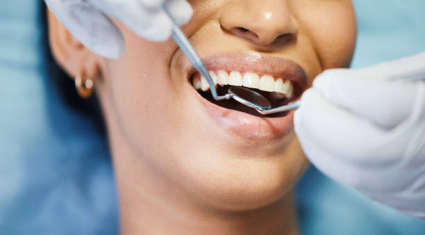 Best Emergency Tooth Extraction in Santa Clara, OR